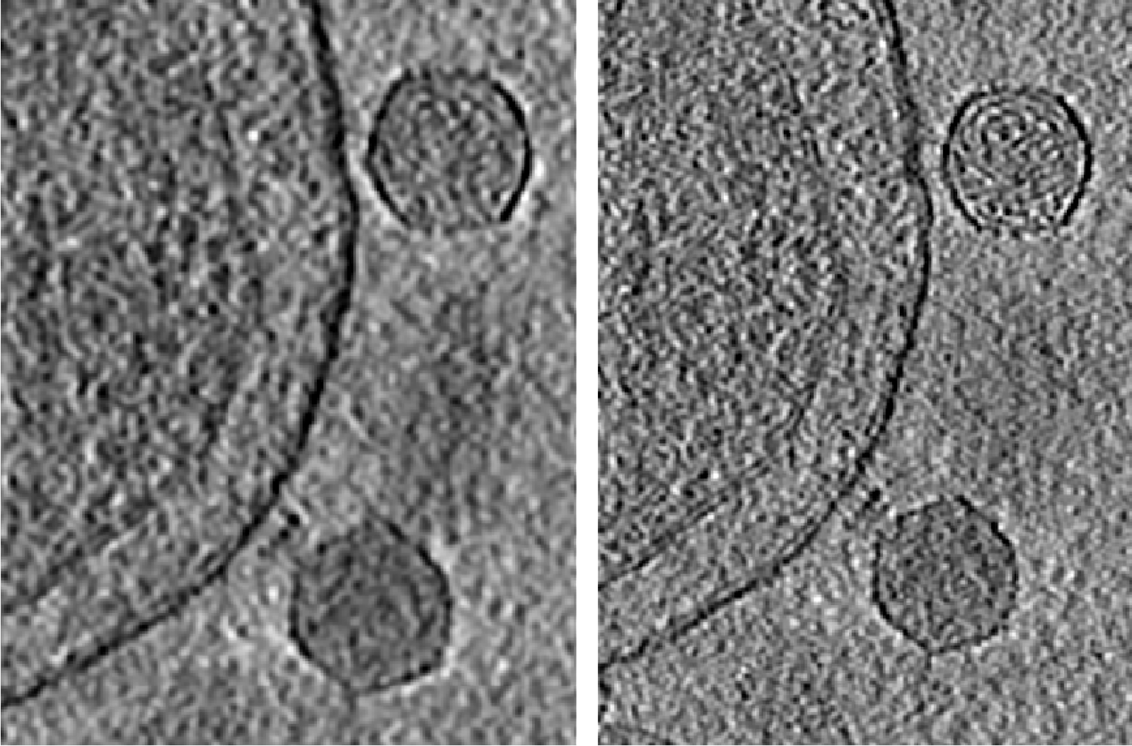 polish tomogram